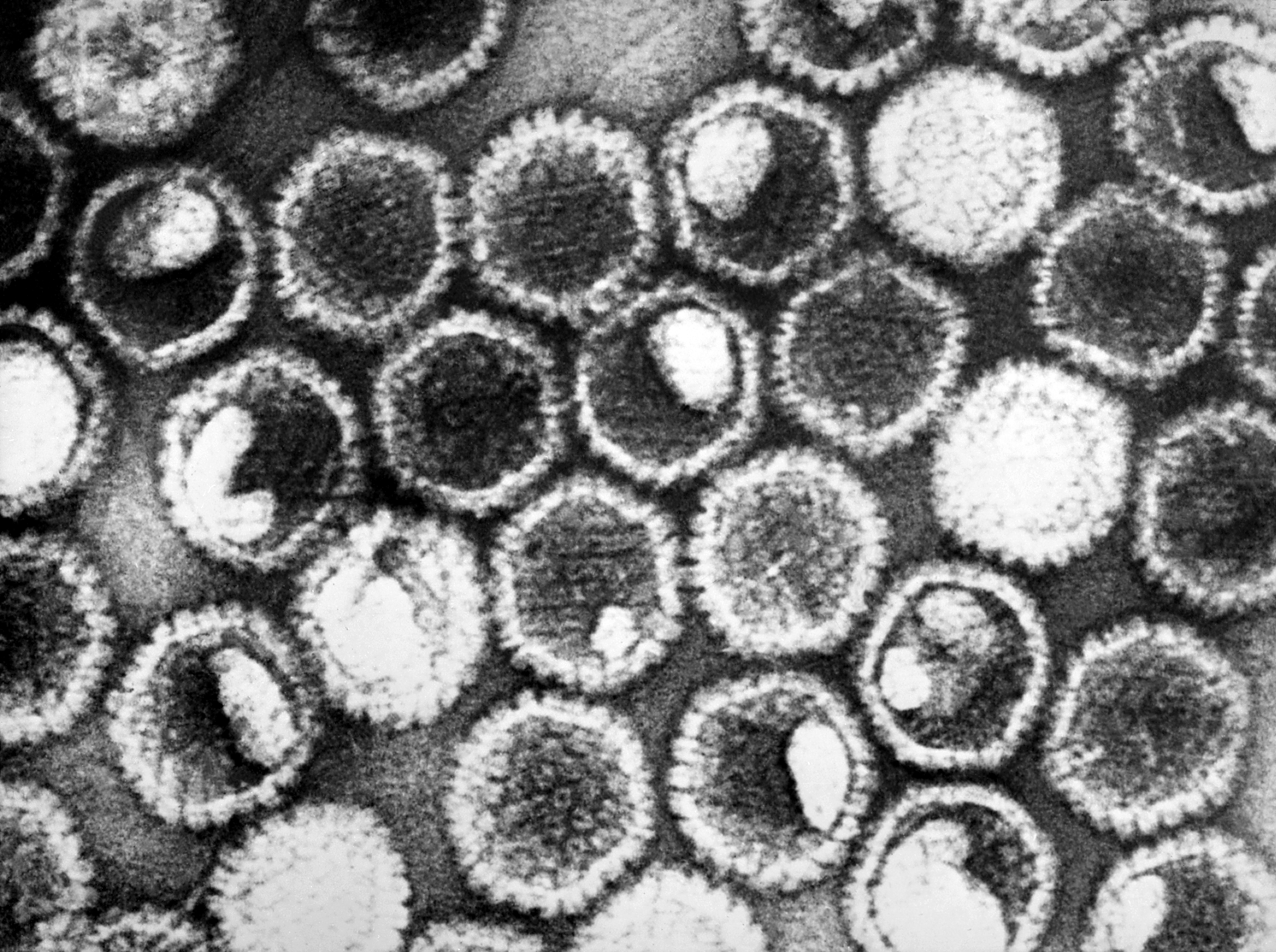 151027_HerpesSimplex_BW