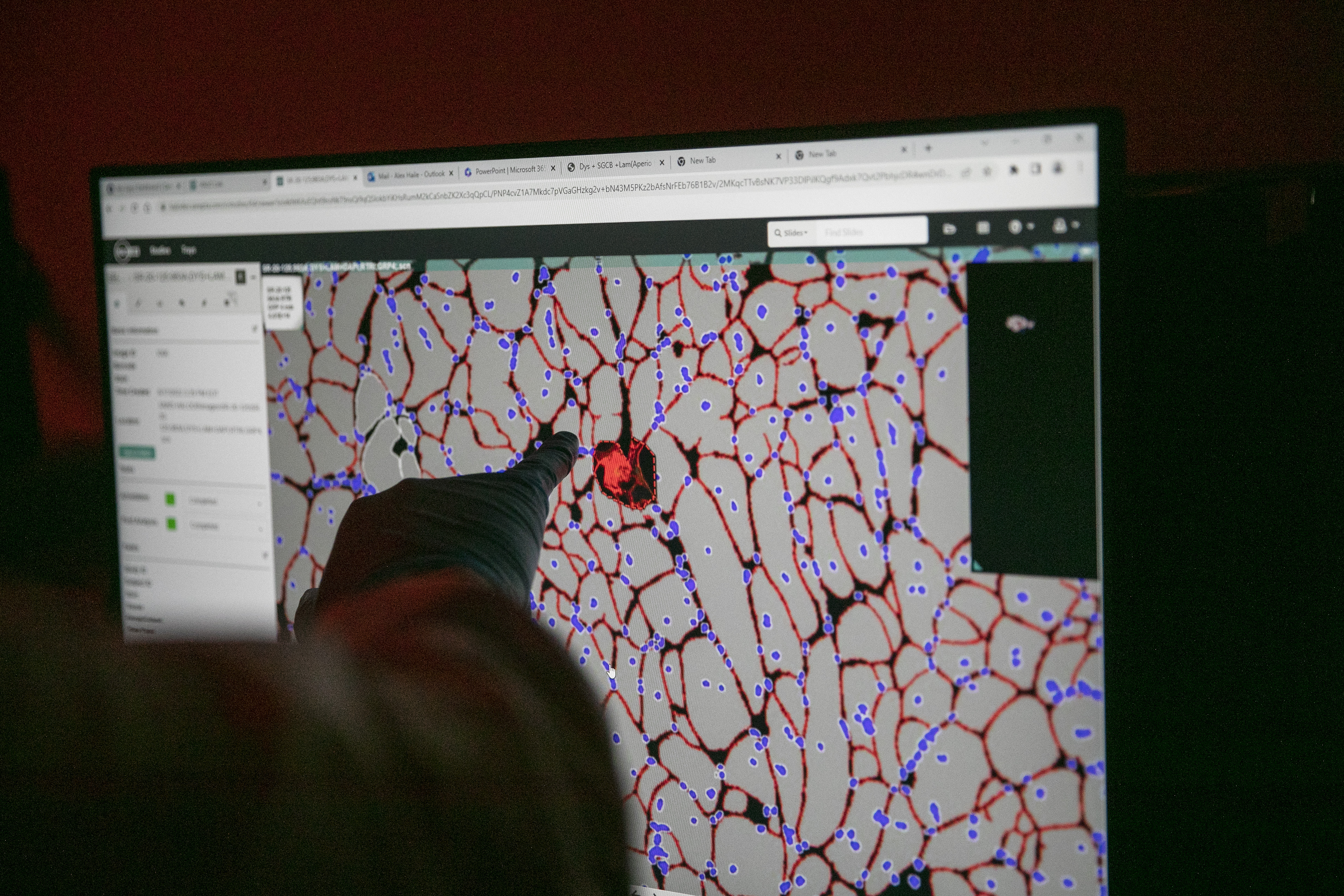 20230406_mcgarvey_Sarepta_0914