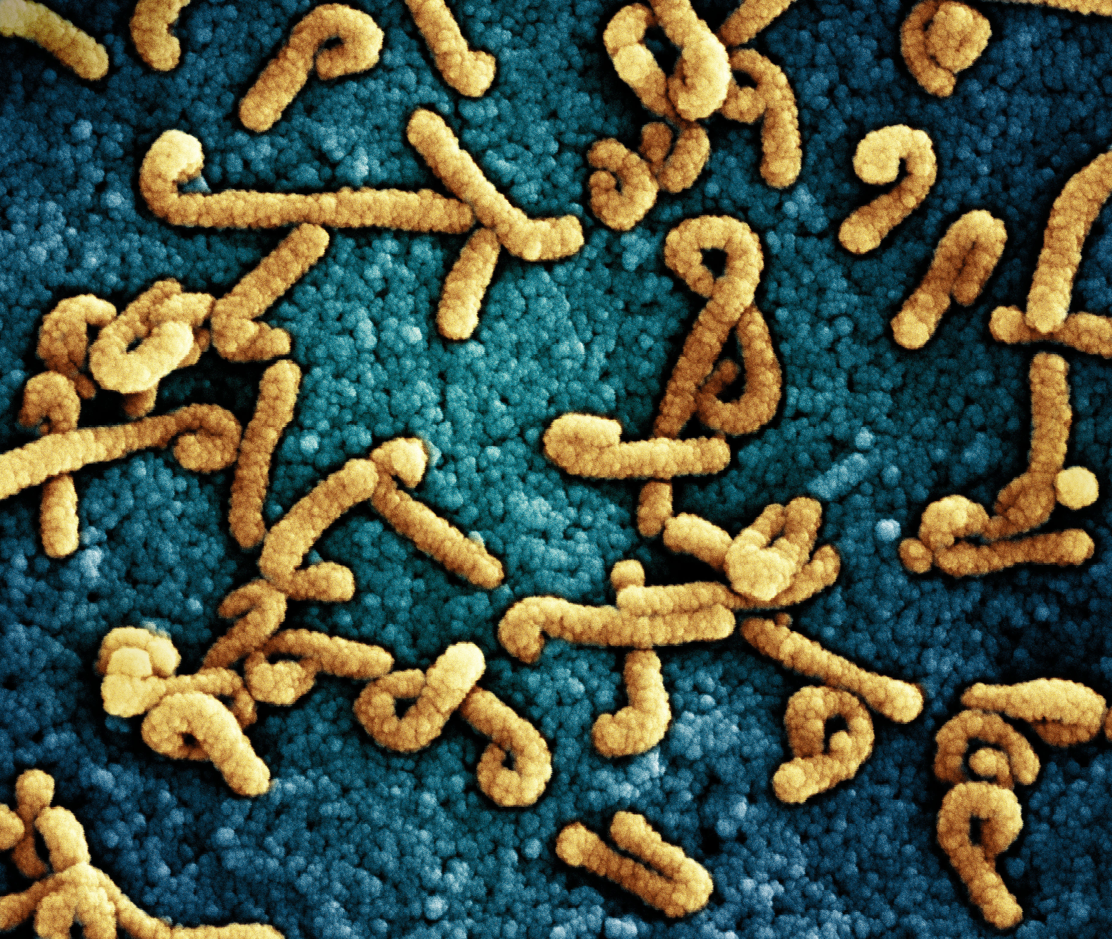 A close-up of Marburg virus particles. They look like Jax cheese puffs!