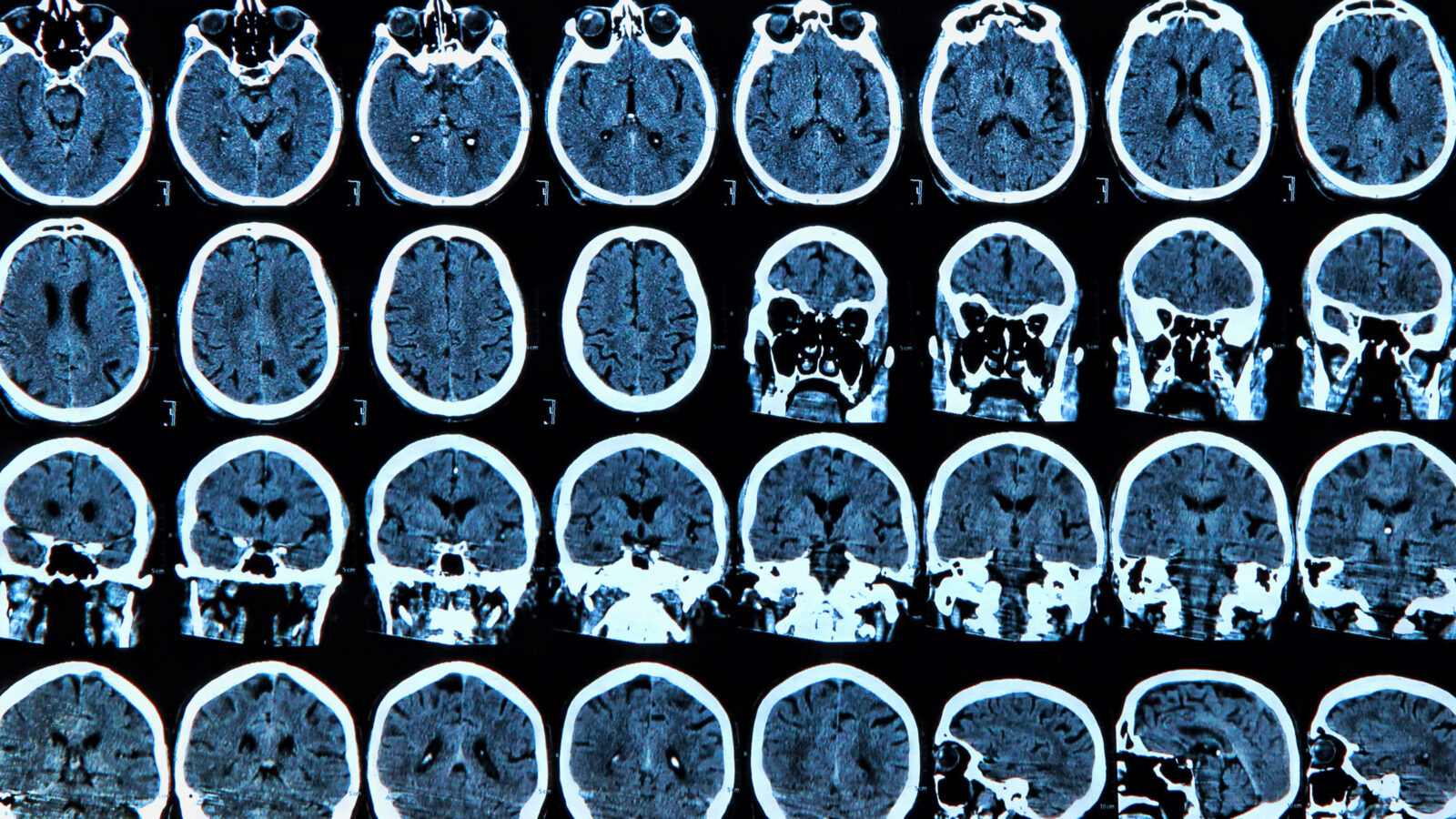 AdobeStock_73055193-1600x900