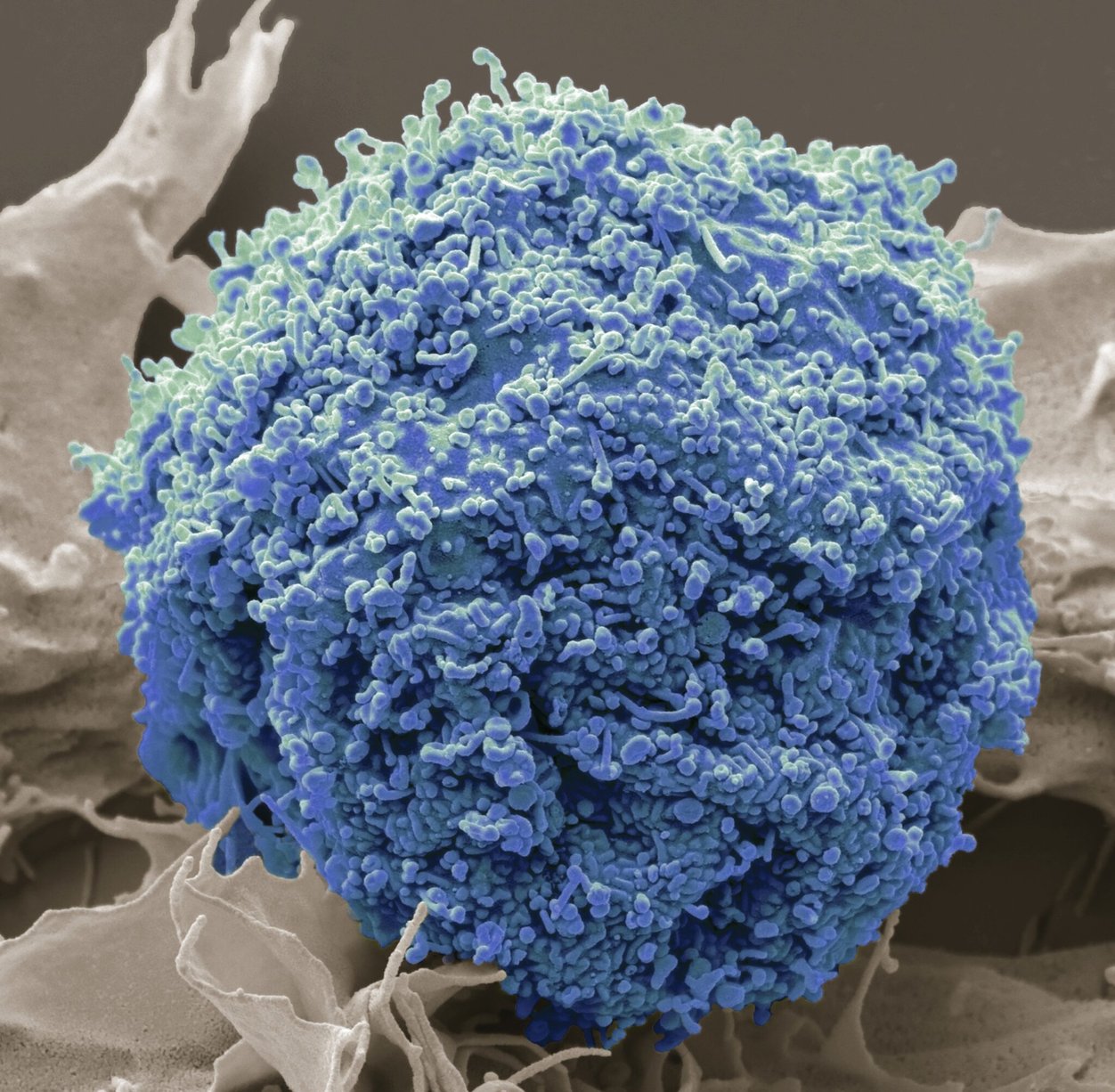 A round blue blob that is also stringy. Technically: A cultured cell releasing large numbers of extracellular vesicles, which bud from the cell's surface