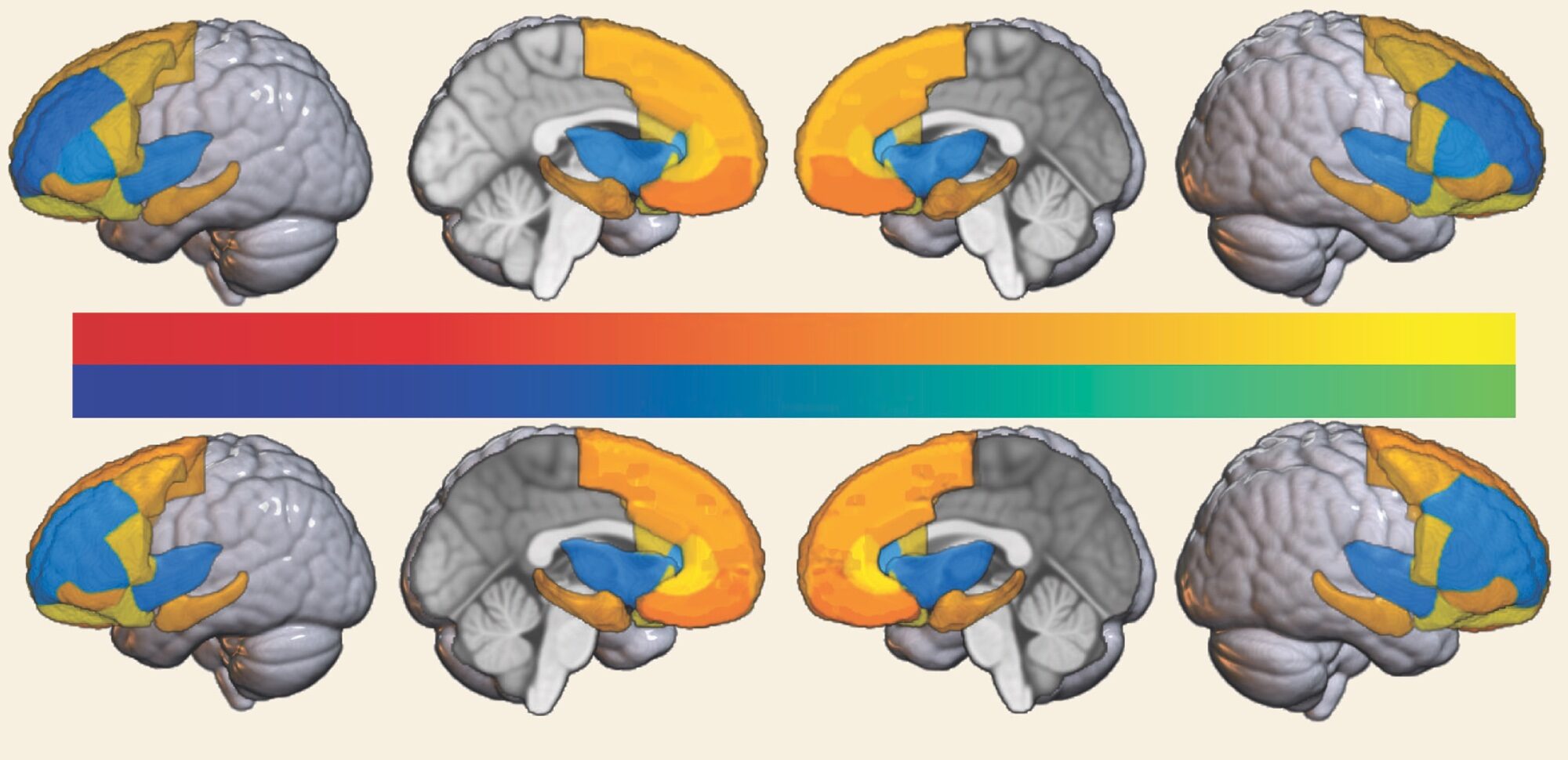 Images showing differences in gray matter volume between Black and white children