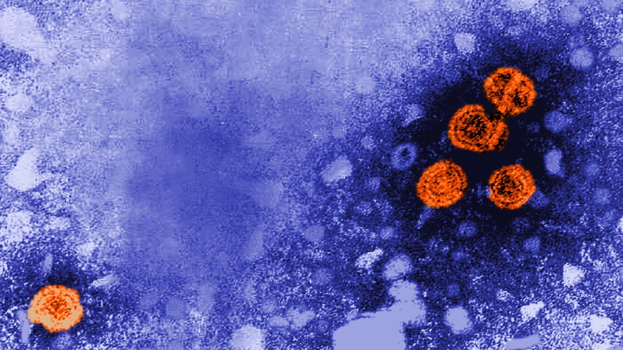 Electron microscopic image of hepatitis B virus particles (orange spheres against a purpleish blue background).