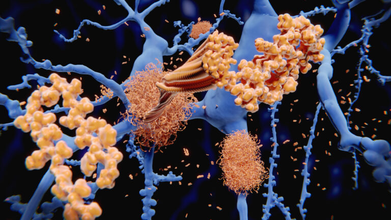 Amyloid beta peptide developing into fibrils