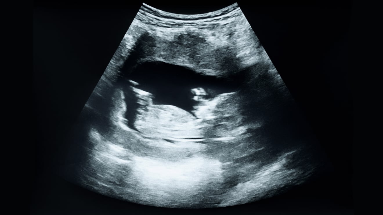 UltrasoundAdobeStock_522060404