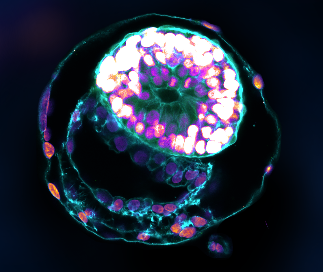 A stem cell–derived human embryo model at a developmental stage equivalent to that of a human embryo at day 12