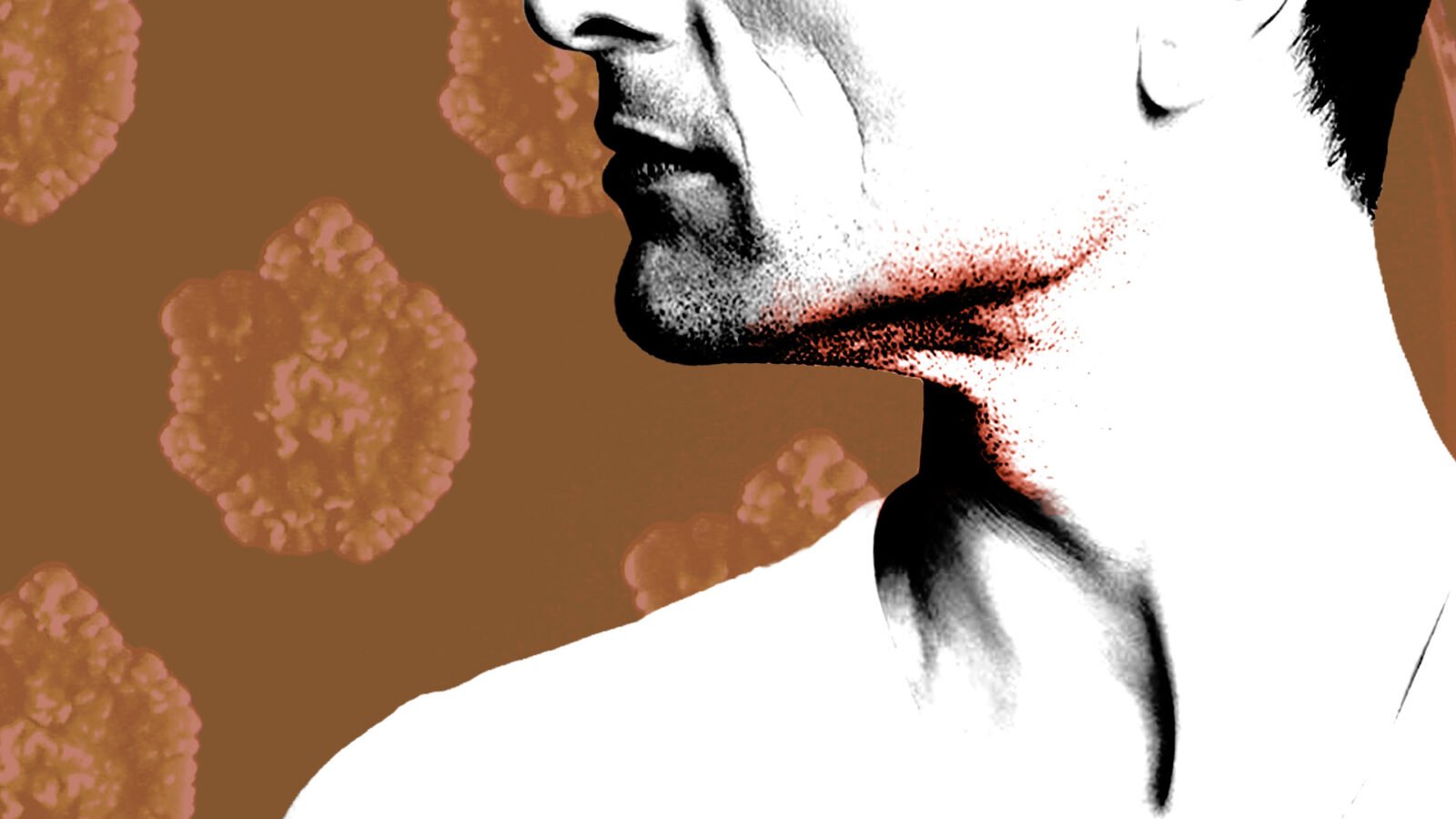 A black and white image of a man's neck, with red spreading around the chin. Blood cells make up the image background.