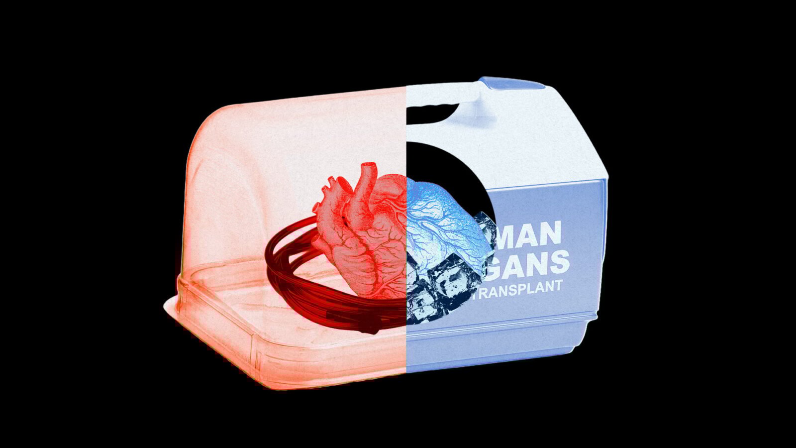 A box with a heart inside for transplantation. Divided: On the right side, red, kept warm, but on the left side, in an Igloo container, blue, kept cold.