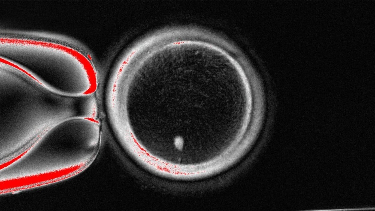 A human somatic cell nuclear transfer oocyte with visible spindle (bright spot inside) before fertilization